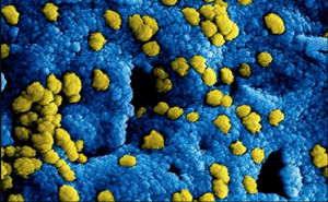 Imagen de microscopio electrónico con partículas de coronavirus en amarillo sobre la superficie de una célula